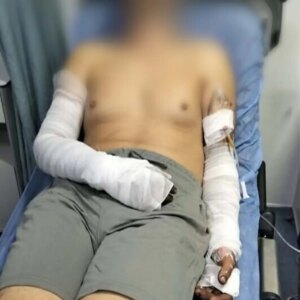 manisada sanayi sitesinde patlama 2 yarali GDOkPuiz